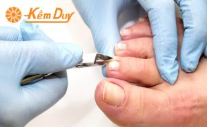 huong dan cach cat mong tay mong chan cho bi tieu duong